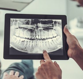 Digital Dental X-rays