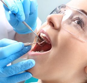 Root Canal Therapy Treatment