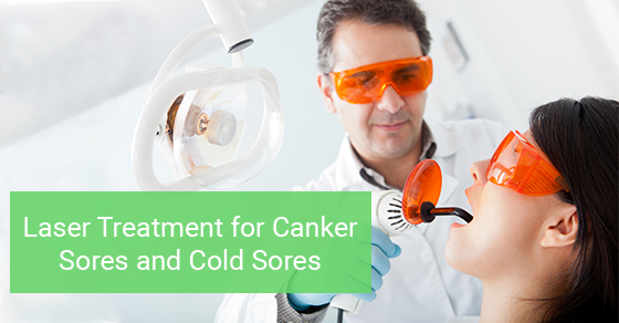 Best treatment for canker sore
