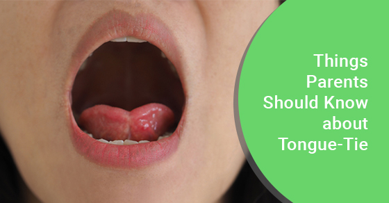 Things Parents Should Know about Tongue-Tie