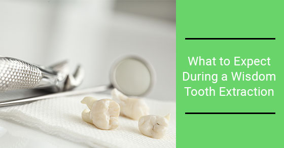 What to Expect During a Wisdom Tooth Extraction
