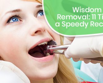 Wisdom Teeth Removal: 11 Tips for a Speedy Recovery