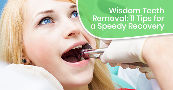 Wisdom Teeth Removal: 11 Tips for a Speedy Recovery