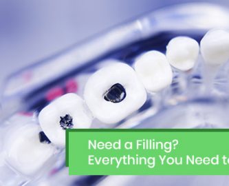 Everything You Need to Know about teeth filling