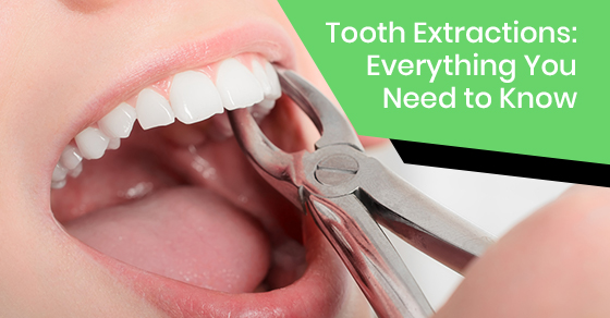 Did your dentist prescribe a tooth extraction? Here’s everything you need to know to prepare, recover faster, and prevent other dental problems later on: