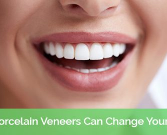 How Porcelain Veneers Can Change Your Smile