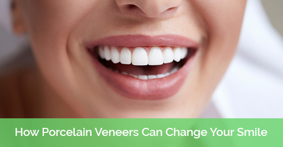 How Porcelain Veneers Can Change Your Smile