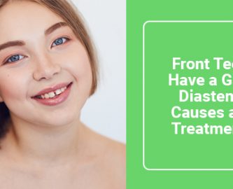 Front teeth have a gap? Diastema causes and treatments