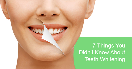 7 Things You Didn’t Know About Teeth Whitening