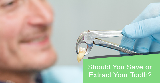 Should you save or extract your tooth?