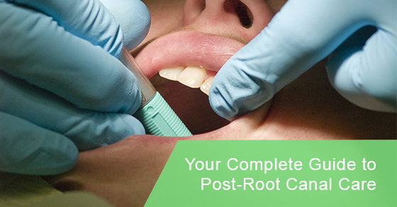 Important root canal recovery tips