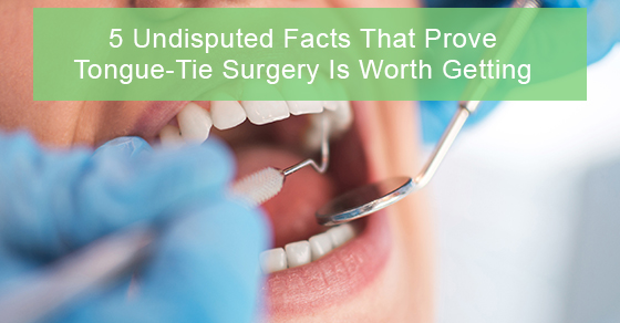 5 Undisputed Facts That Prove Tongue-Tie Surgery Is Worth Getting