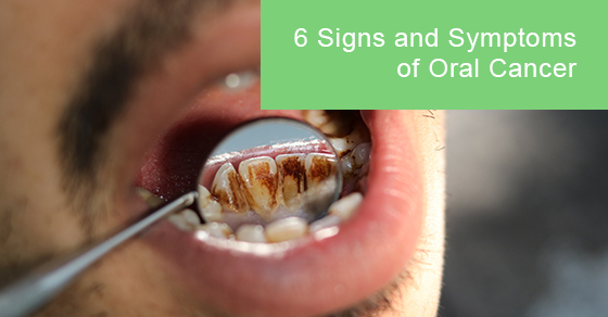 Signs and symptoms of oral cancer