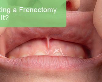 Is getting a frenectomy worth it?