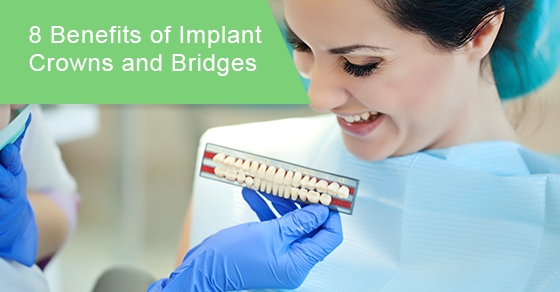 8 benefits of implant crowns and bridges