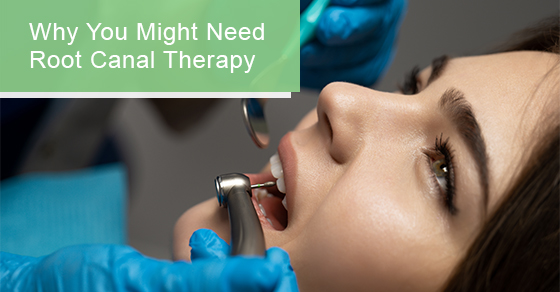 Why you might need root canal therapy
