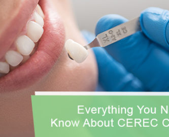 Everything you need to know about CEREC crowns