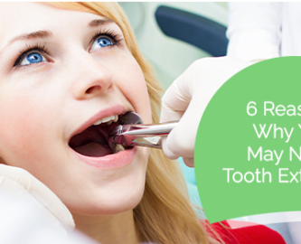 Reasons why you may need tooth extraction