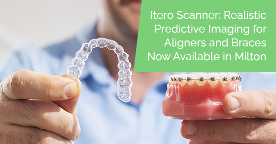 Itero scanner: Realistic predictive imaging for aligners and braces now available in Milton