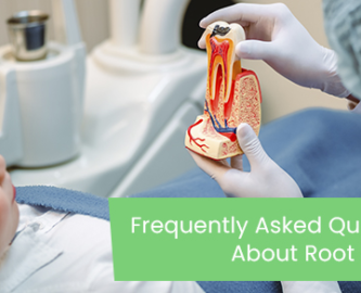 Frequently asked questions about root canals