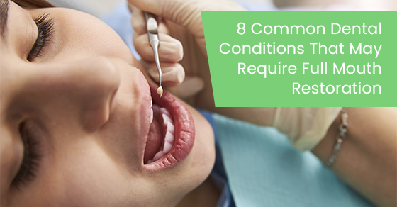 8 common dental conditions that may require full mouth restoration