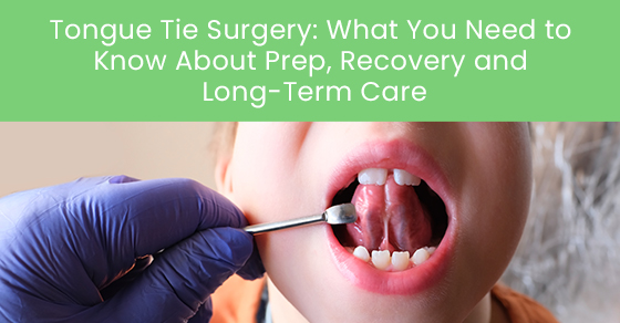 Tongue tie surgery: What you need to know about prep, recovery and long-term care